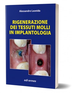 Rigenerazione dei tessuti molli in implantologia